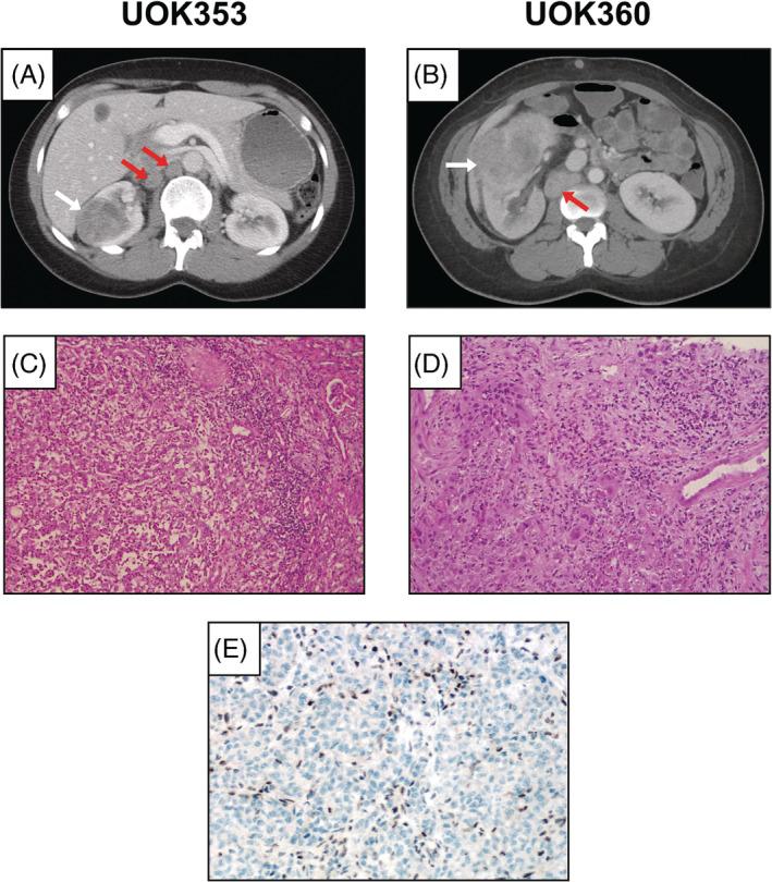 https://cdn.ncbi.nlm.nih.gov/pmc/blobs/1fb0/7383978/9f1f1ad164d6/GCC-59-472-g001.jpg