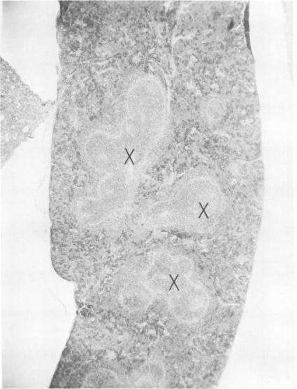 https://cdn.ncbi.nlm.nih.gov/pmc/blobs/1fb6/420689/2e32c5c3ceaa/iai00219-0222-a.jpg