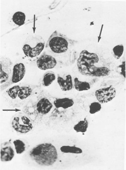 https://cdn.ncbi.nlm.nih.gov/pmc/blobs/1fb6/420689/680d3f4f9341/iai00219-0221-a.jpg