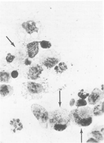 https://cdn.ncbi.nlm.nih.gov/pmc/blobs/1fb6/420689/6e0f0be8497d/iai00219-0220-a.jpg