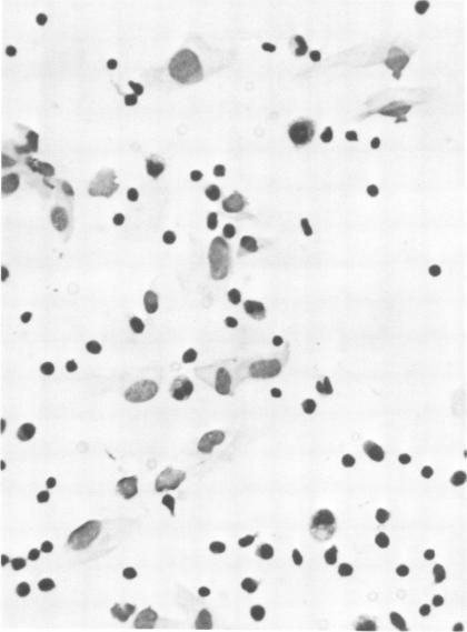 https://cdn.ncbi.nlm.nih.gov/pmc/blobs/1fb6/420689/e42854cca242/iai00219-0217-a.jpg