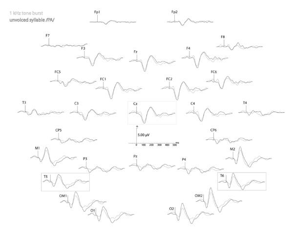 https://cdn.ncbi.nlm.nih.gov/pmc/blobs/1fb9/2662863/a989527cca02/1471-2202-10-23-2.jpg