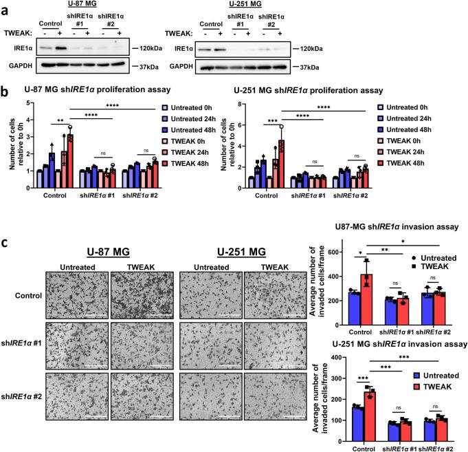 https://cdn.ncbi.nlm.nih.gov/pmc/blobs/1fba/10122670/6501fbabfd5f/42003_2023_4821_Fig5_HTML.jpg