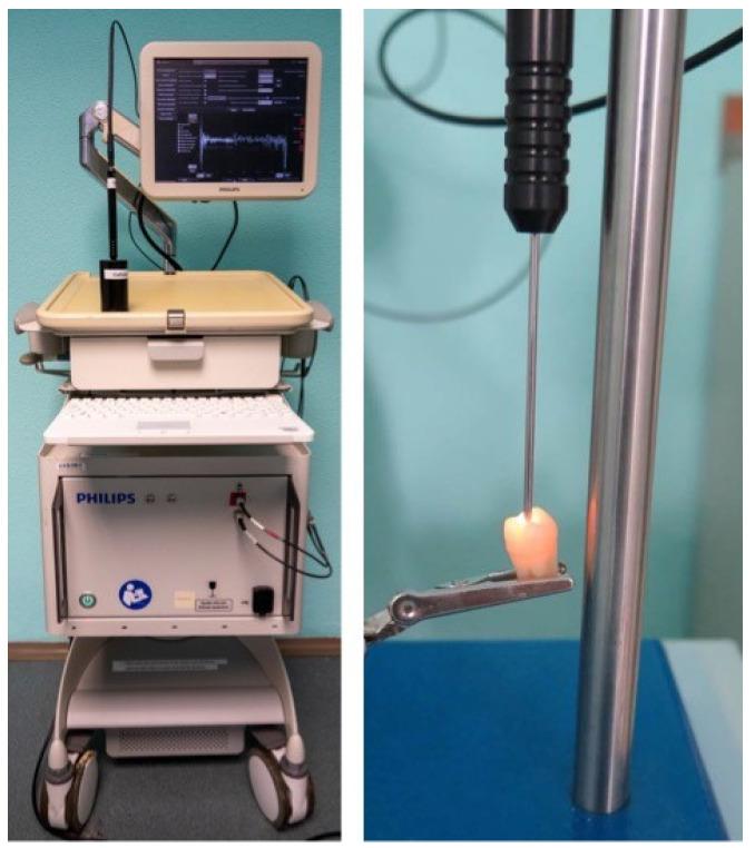 https://cdn.ncbi.nlm.nih.gov/pmc/blobs/1fba/10252735/6ef4de7b4896/diagnostics-13-01878-g001.jpg