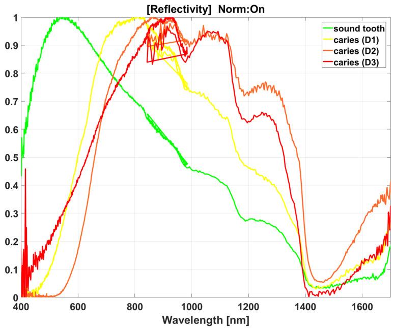 https://cdn.ncbi.nlm.nih.gov/pmc/blobs/1fba/10252735/f274852f9882/diagnostics-13-01878-g002.jpg