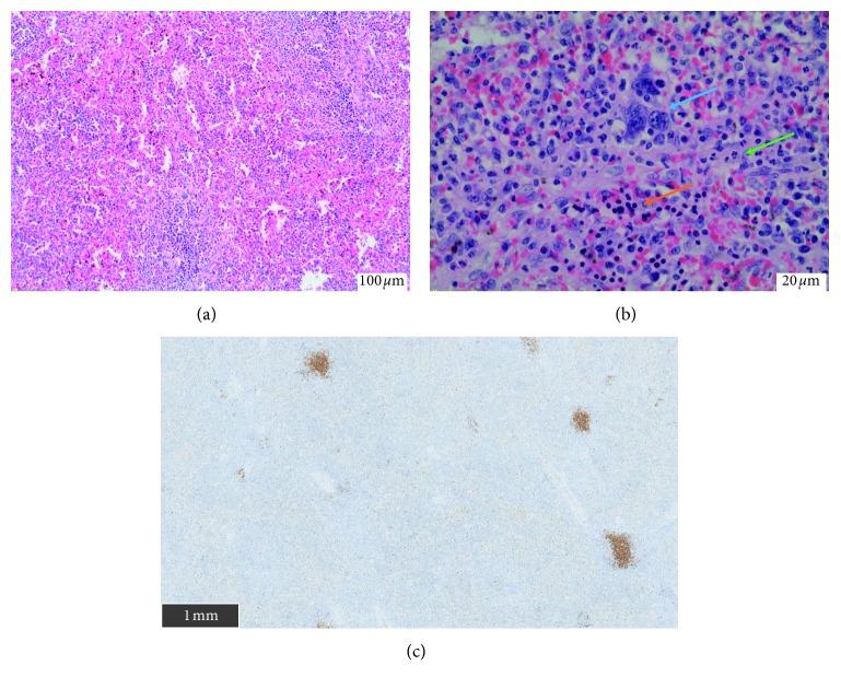https://cdn.ncbi.nlm.nih.gov/pmc/blobs/1fbc/6512020/4c40480f01ad/CRIHEM2019-9625075.005.jpg