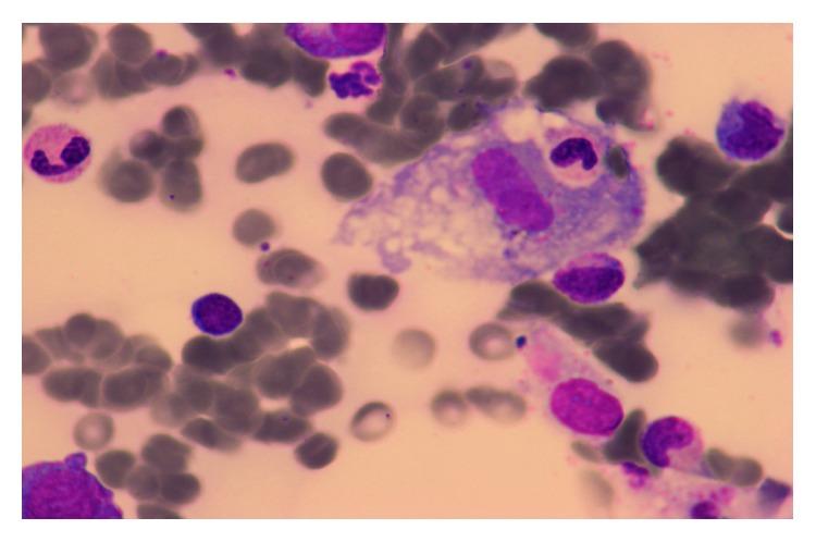 https://cdn.ncbi.nlm.nih.gov/pmc/blobs/1fbc/6512020/6fecf133d319/CRIHEM2019-9625075.002.jpg