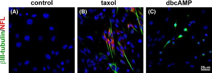 https://cdn.ncbi.nlm.nih.gov/pmc/blobs/1fc0/4714640/1109a21da93e/BRB3-5-e00414-g005.jpg