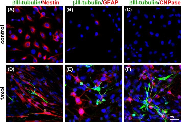 https://cdn.ncbi.nlm.nih.gov/pmc/blobs/1fc0/4714640/124336951989/BRB3-5-e00414-g002.jpg