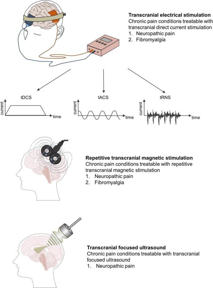 https://cdn.ncbi.nlm.nih.gov/pmc/blobs/1fc6/9179147/a79314af76b9/fnmol-15-888716-g003.jpg