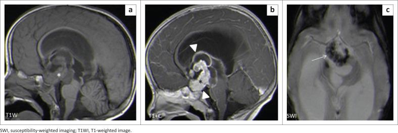 https://cdn.ncbi.nlm.nih.gov/pmc/blobs/1fc8/8182454/b99b4b239748/SAJR-25-2042-g010.jpg