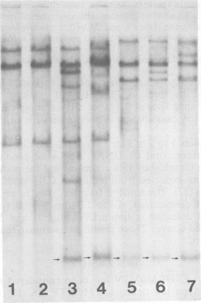 https://cdn.ncbi.nlm.nih.gov/pmc/blobs/1fc9/256106/41e7b5a564c3/jvirol00154-0173-b.jpg
