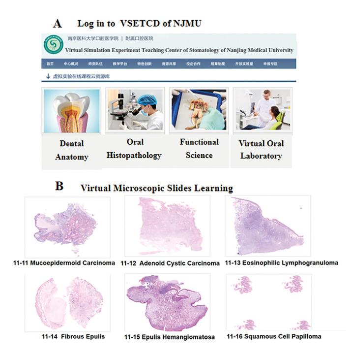 https://cdn.ncbi.nlm.nih.gov/pmc/blobs/1fcb/8254891/788c7551303d/medoral-26-e533-g003.jpg