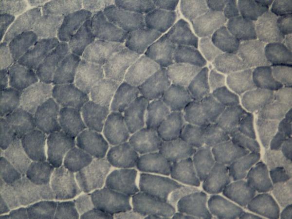 https://cdn.ncbi.nlm.nih.gov/pmc/blobs/1fd7/4629627/227f50d9cb92/amjcaserep-16-763-g003.jpg