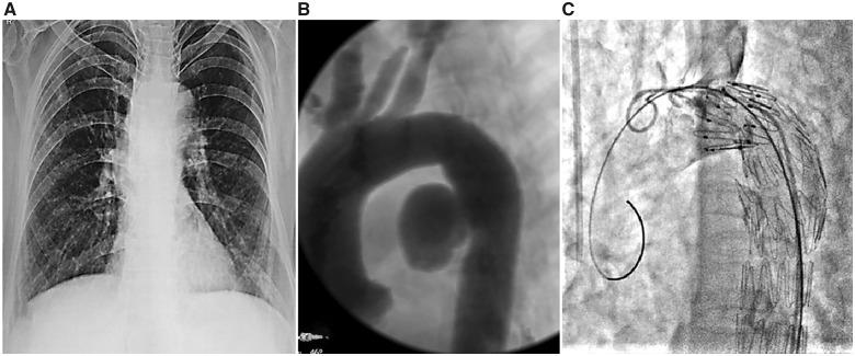 https://cdn.ncbi.nlm.nih.gov/pmc/blobs/1fdb/7649481/bcdb0da9e88d/ytaa295f1.jpg