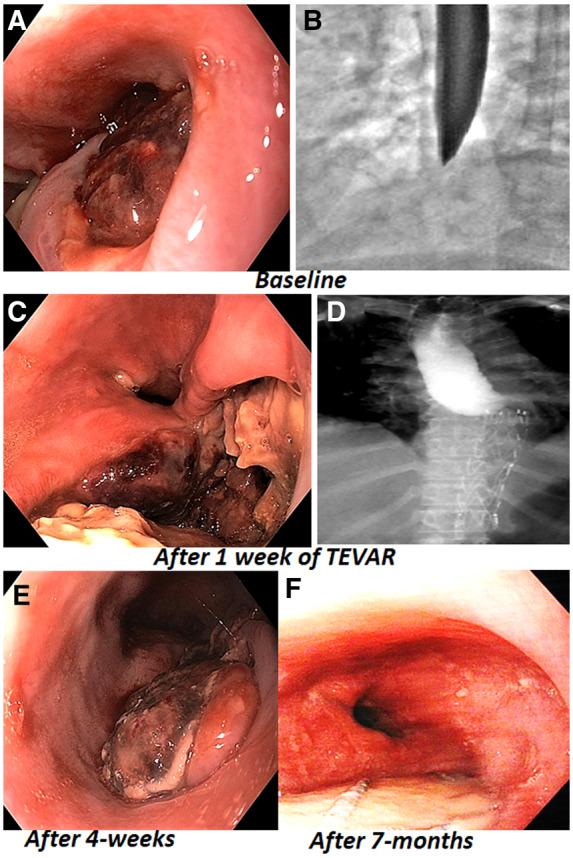 https://cdn.ncbi.nlm.nih.gov/pmc/blobs/1fdb/7649481/fe273be874b6/ytaa295f4.jpg