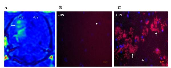 https://cdn.ncbi.nlm.nih.gov/pmc/blobs/1fdc/3020671/2ce39b8dca09/1471-2377-10-114-2.jpg