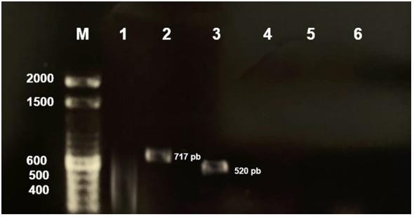 https://cdn.ncbi.nlm.nih.gov/pmc/blobs/1fdd/11263102/317319e71f40/fcimb-14-1354736-g001.jpg