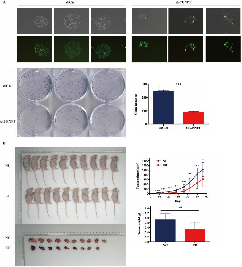 https://cdn.ncbi.nlm.nih.gov/pmc/blobs/1fe4/7757141/cd06b5e79814/ijmsv18p0494g005.jpg