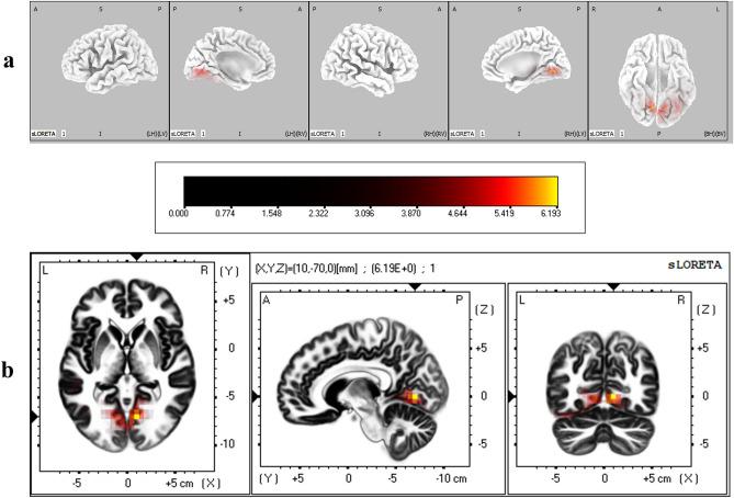 https://cdn.ncbi.nlm.nih.gov/pmc/blobs/1fea/8593020/56d2145e99c2/41598_2021_1579_Fig8_HTML.jpg