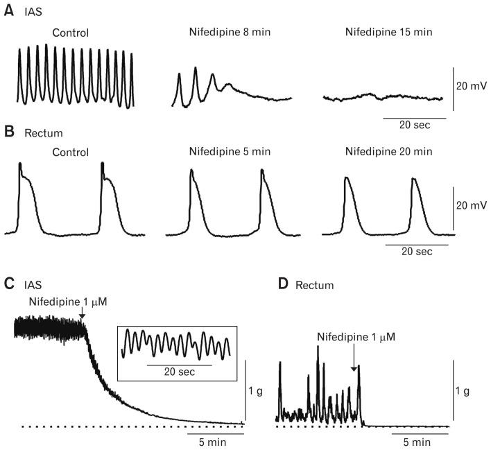 https://cdn.ncbi.nlm.nih.gov/pmc/blobs/1fec/6474703/4d332140df95/jnm-25-189f5.jpg