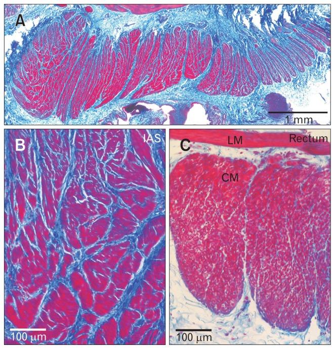 https://cdn.ncbi.nlm.nih.gov/pmc/blobs/1fec/6474703/8ae2331f653f/jnm-25-189f1.jpg