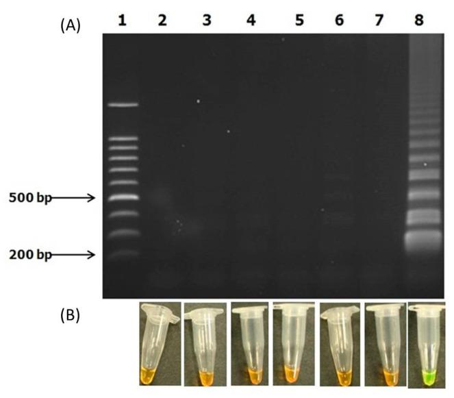 https://cdn.ncbi.nlm.nih.gov/pmc/blobs/1fec/9786892/c07a4c36d9cf/microorganisms-10-02346-g004.jpg