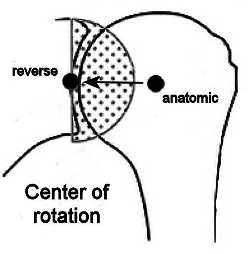 https://cdn.ncbi.nlm.nih.gov/pmc/blobs/1ff2/7459385/d2faa1cd2d49/or-12-s1-8659-g003.jpg
