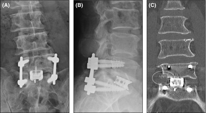 https://cdn.ncbi.nlm.nih.gov/pmc/blobs/1ff4/4856240/b74862203f34/CCR3-4-477-g003.jpg