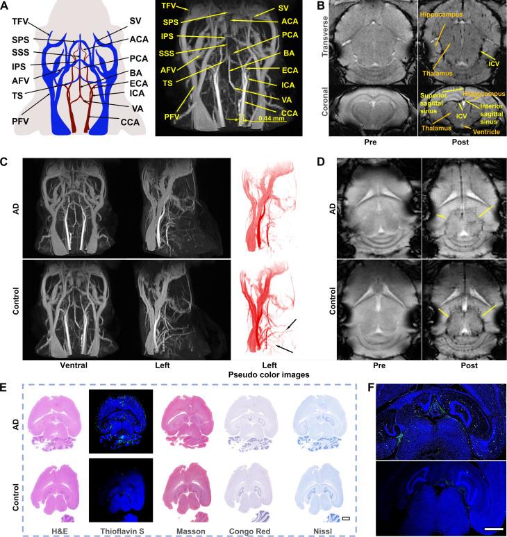https://cdn.ncbi.nlm.nih.gov/pmc/blobs/1ff5/11451532/ed4b69c46809/sciadv.adq4082-f4.jpg