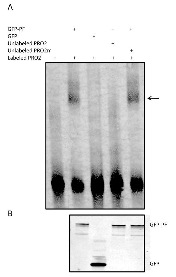 https://cdn.ncbi.nlm.nih.gov/pmc/blobs/1ff7/3453510/b9b0a5e73547/1471-2407-12-154-5.jpg