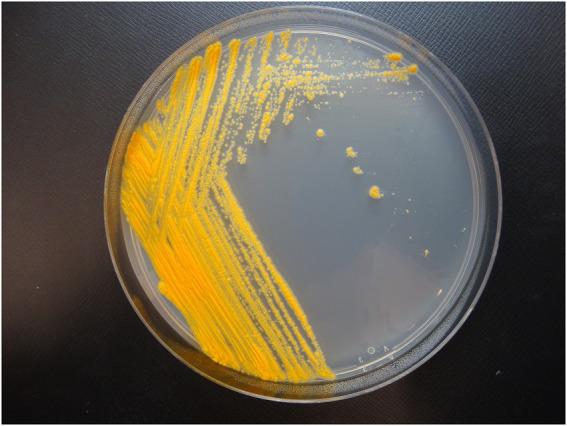 https://cdn.ncbi.nlm.nih.gov/pmc/blobs/1ffb/9589434/0a98cecdcd00/fmicb-13-992610-g001.jpg