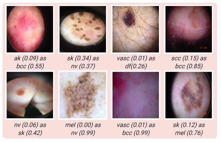 https://cdn.ncbi.nlm.nih.gov/pmc/blobs/2001/9457478/862279e37193/jcm-11-05102-g006.jpg