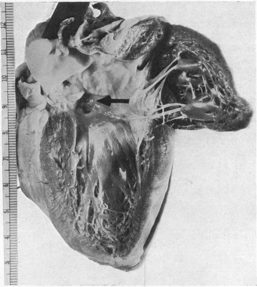 https://cdn.ncbi.nlm.nih.gov/pmc/blobs/2008/503356/df202197e254/brheartj00379-0015-a.jpg
