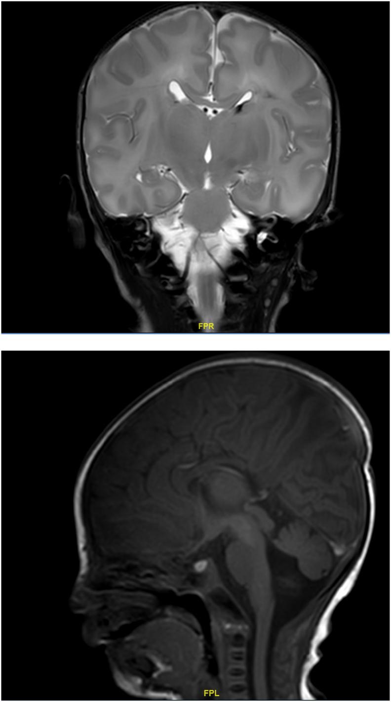 https://cdn.ncbi.nlm.nih.gov/pmc/blobs/2009/8318985/7b304650a700/gr2.jpg