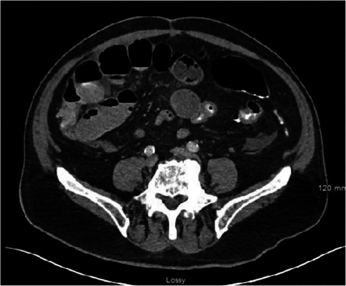 https://cdn.ncbi.nlm.nih.gov/pmc/blobs/2010/12397815/65e430d97e2c/gr1.jpg