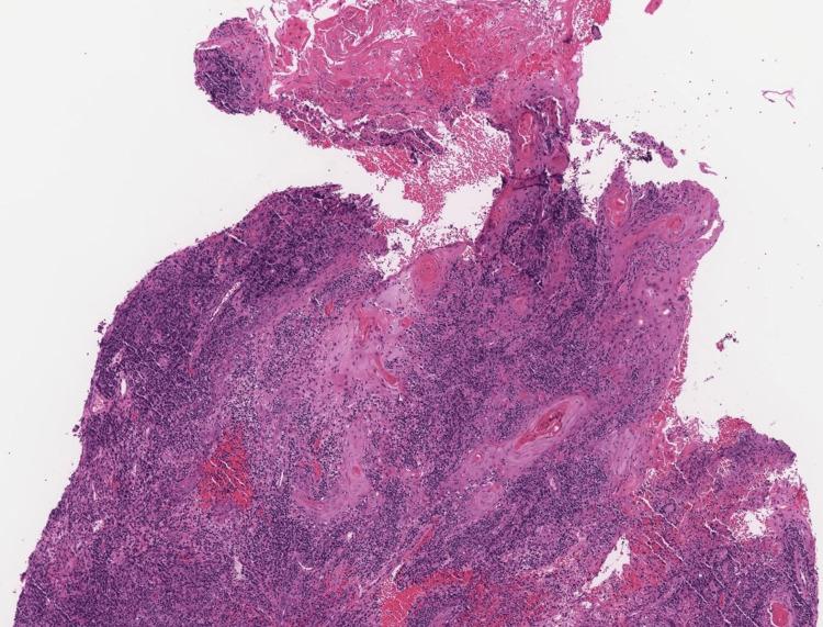 https://cdn.ncbi.nlm.nih.gov/pmc/blobs/2011/11463825/14543274ad4d/cureus-0016-00000069012-i02.jpg