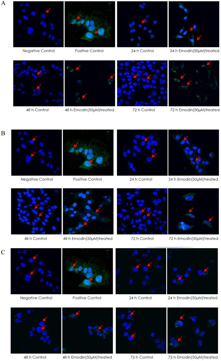 https://cdn.ncbi.nlm.nih.gov/pmc/blobs/2014/7778552/8ecb7182f4d2/jcav12p0652g020.jpg