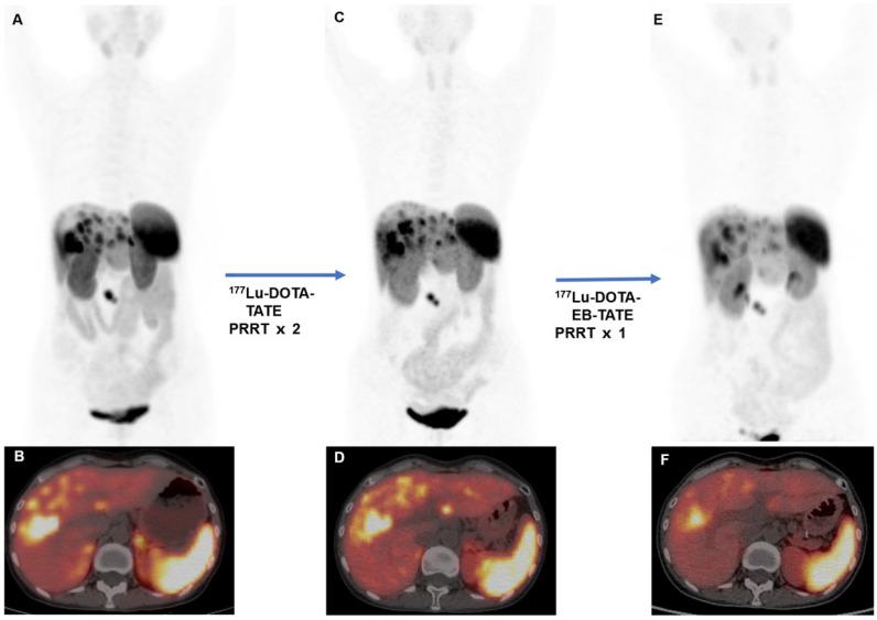 https://cdn.ncbi.nlm.nih.gov/pmc/blobs/2015/9516233/e458bbc642fe/thnov12p6437g002.jpg
