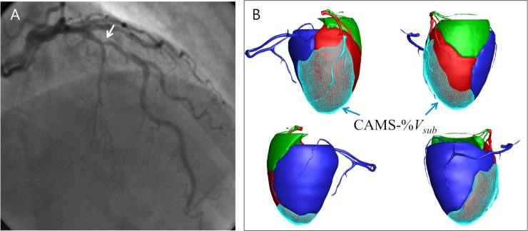 https://cdn.ncbi.nlm.nih.gov/pmc/blobs/2016/6233920/d1003d5f6749/pmed.1002693.g001.jpg