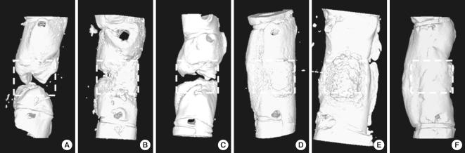 https://cdn.ncbi.nlm.nih.gov/pmc/blobs/2019/3069566/43e5666887e0/jkms-26-482-g004.jpg
