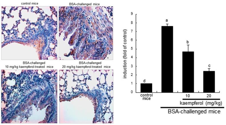 https://cdn.ncbi.nlm.nih.gov/pmc/blobs/201d/4691161/6f4afdc09c89/ijms-16-26218-g003.jpg