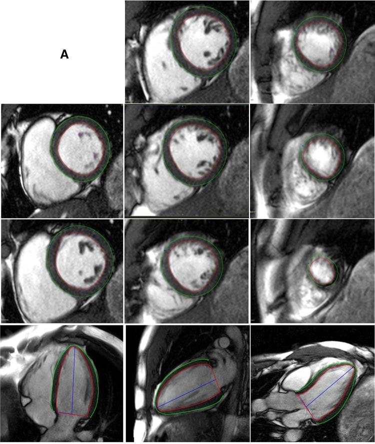 https://cdn.ncbi.nlm.nih.gov/pmc/blobs/2022/5889420/58197d442ca0/10554_2017_1277_Fig1a_HTML.jpg