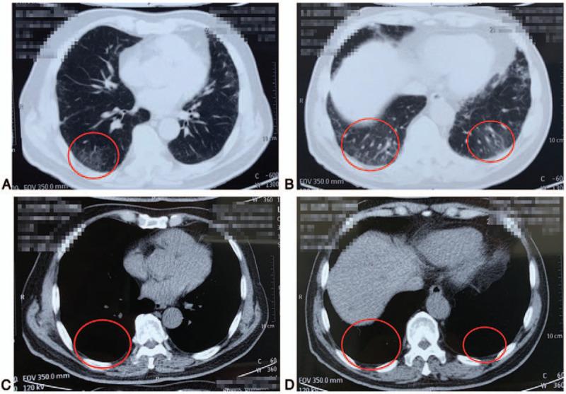 https://cdn.ncbi.nlm.nih.gov/pmc/blobs/2022/7793440/4c6da400f05c/medi-100-e24018-g003.jpg