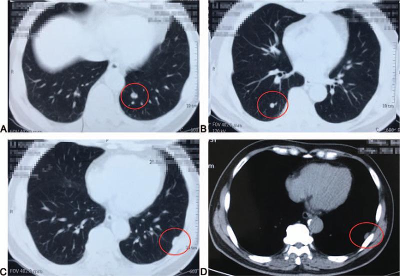 https://cdn.ncbi.nlm.nih.gov/pmc/blobs/2022/7793440/7a8d2916d610/medi-100-e24018-g001.jpg