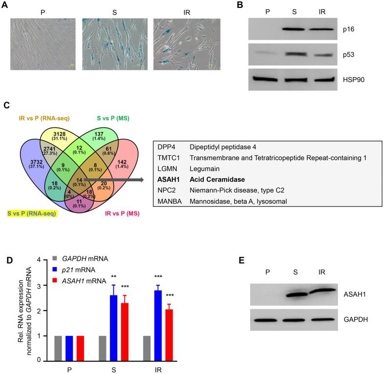 https://cdn.ncbi.nlm.nih.gov/pmc/blobs/202c/8266329/642396aa0d5c/aging-13-203170-g001.jpg