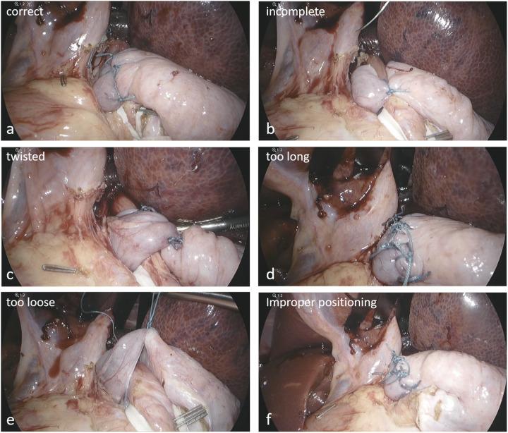 https://cdn.ncbi.nlm.nih.gov/pmc/blobs/202e/12141237/0c48c5fc7482/fped-13-1584628-g001.jpg