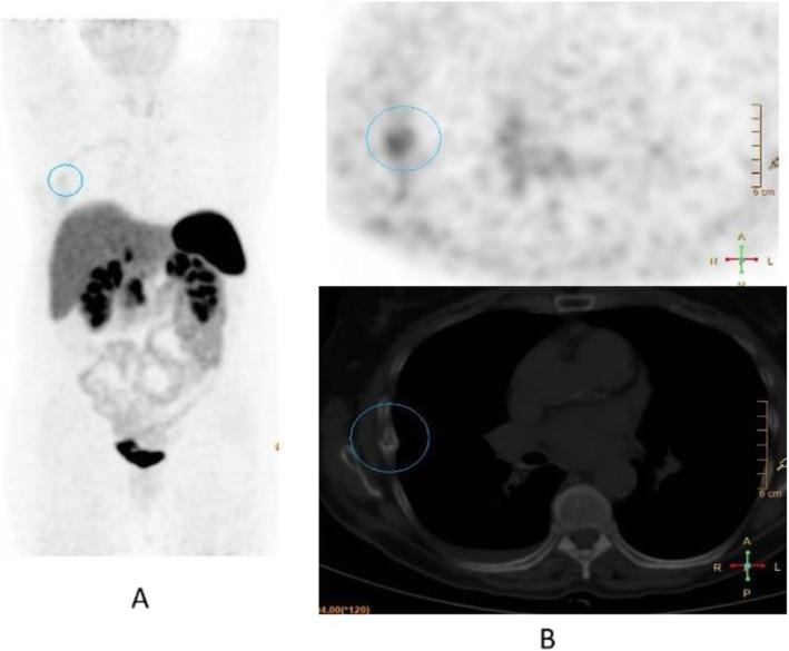 https://cdn.ncbi.nlm.nih.gov/pmc/blobs/2033/8218094/00739b37bb89/41824_2019_66_Fig56_HTML.jpg