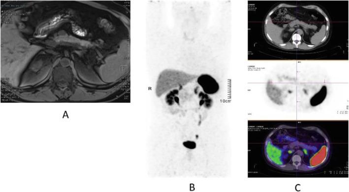 https://cdn.ncbi.nlm.nih.gov/pmc/blobs/2033/8218094/03db2ec83a5d/41824_2019_66_Fig49_HTML.jpg