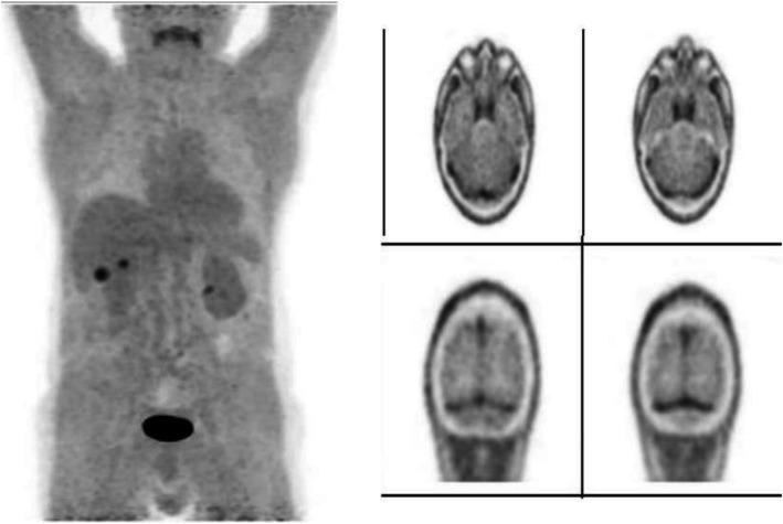 https://cdn.ncbi.nlm.nih.gov/pmc/blobs/2033/8218094/0c6ca8e032f9/41824_2019_66_Fig7_HTML.jpg